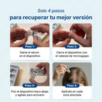 Hair Biolabs | Sistema de Microinfusión para el crecimiento del cabello