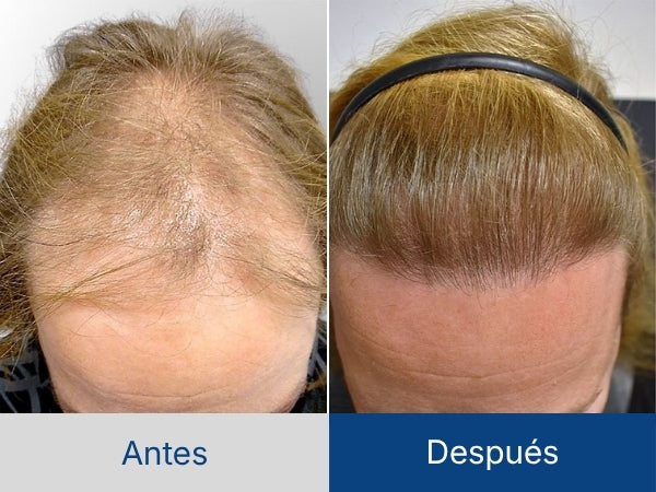 Andrea