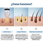 Hair Biolabs | Sistema de Microinfusión para el crecimiento del cabello