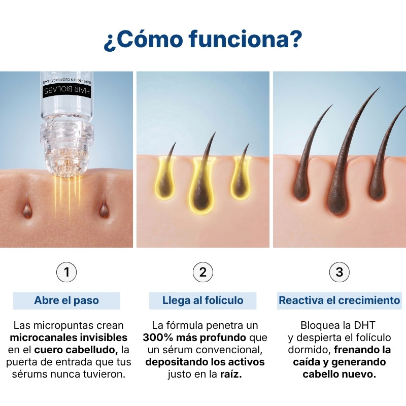 Hair Biolabs | Sistema de Microinfusión para el crecimiento del cabello